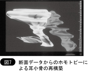 断面データからホモトピーによる耳小骨の再構築