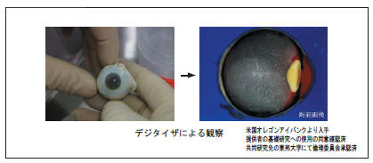 人の眼の観察例