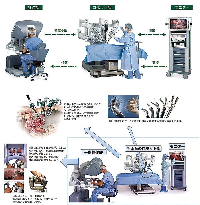 手術支援ロボット「ダ・ヴィンチ